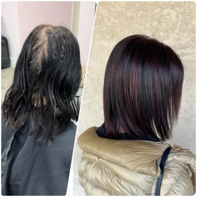 Before and after results of a hair transformation with visible scalp coverage and glossy dark brown finish