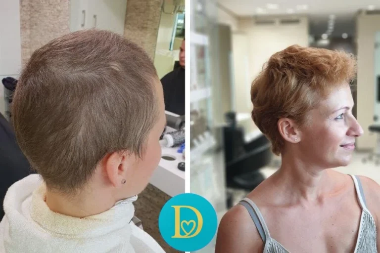 Before and after image of a female client showing the full journey from short regrowth to styled vibrant hair following Dettycated oxygen hair therapy.